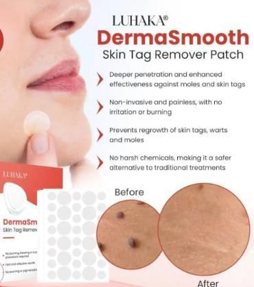 Skin Tag Remover Patch | 🔥Flat 50% Off Sale🔥