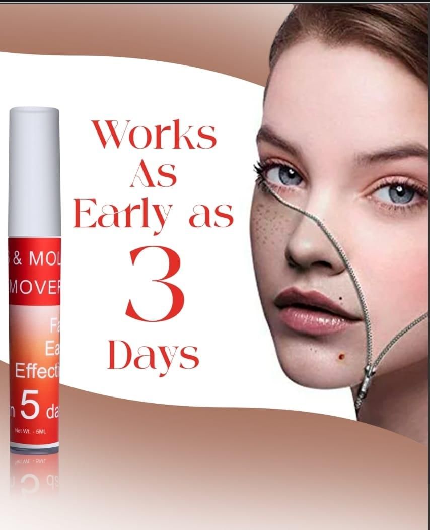 Tags & Moles Remover | 🔥🔥Buy 1 Get 1 Free🔥🔥
